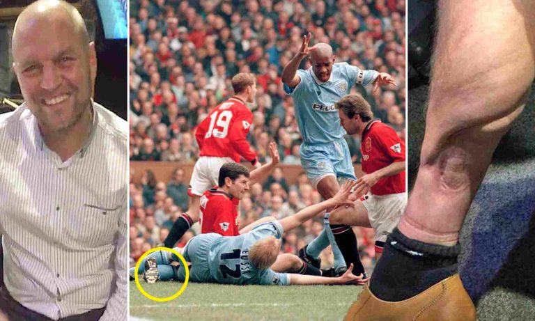 Worst Injuries in Football History E28 Reveals
